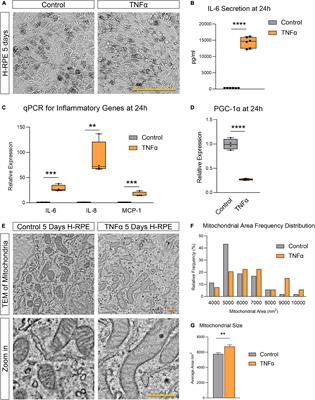 Dimethyl Fumarate Blocks Tumor Necrosis Factor-Alpha-Driven Inflammation and Metabolic Rewiring in the Retinal Pigment Epithelium